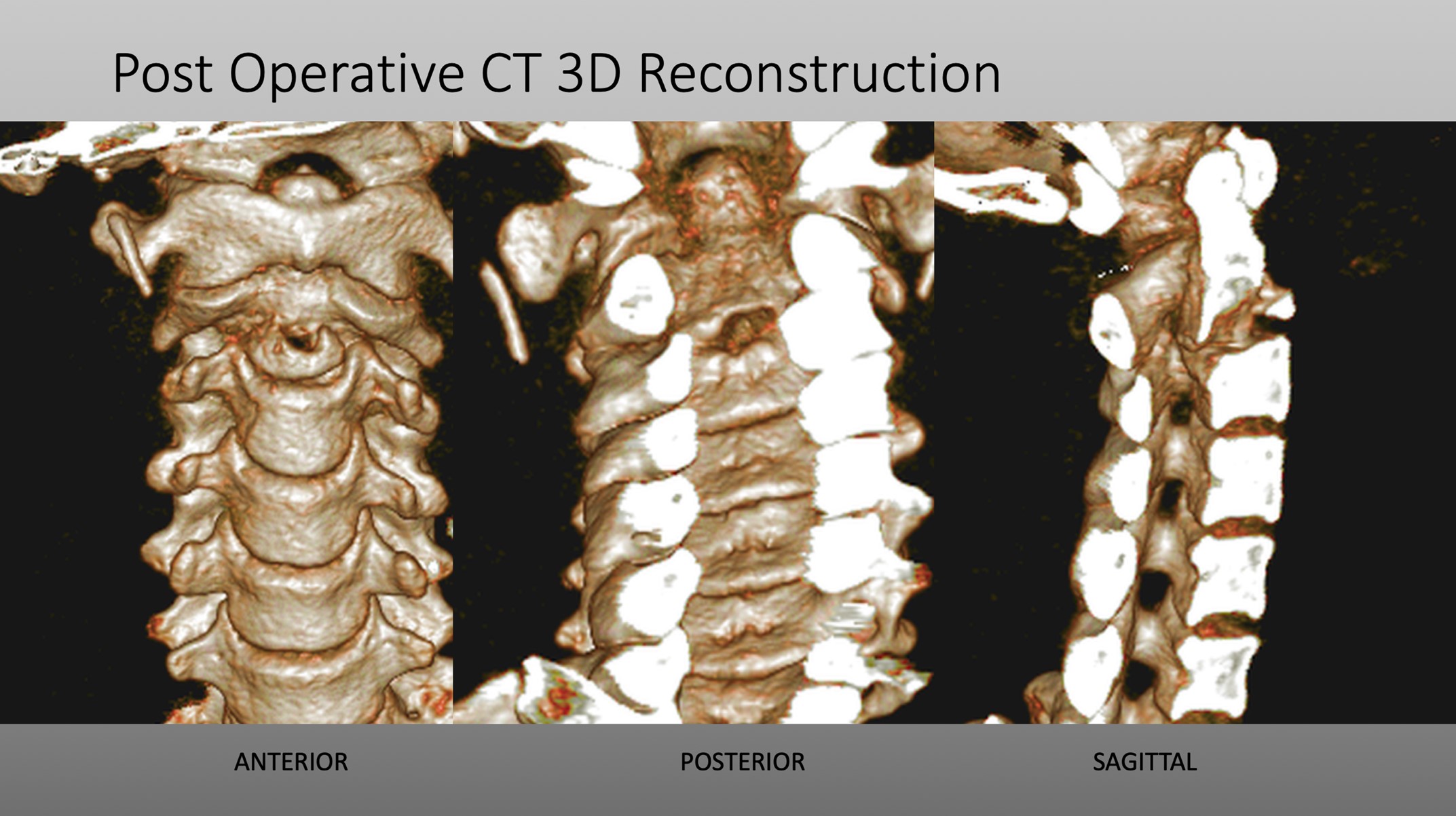 3d Pre Op