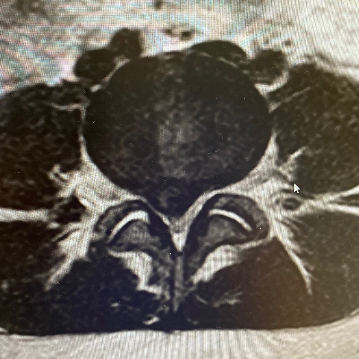 neurosurgery imaging