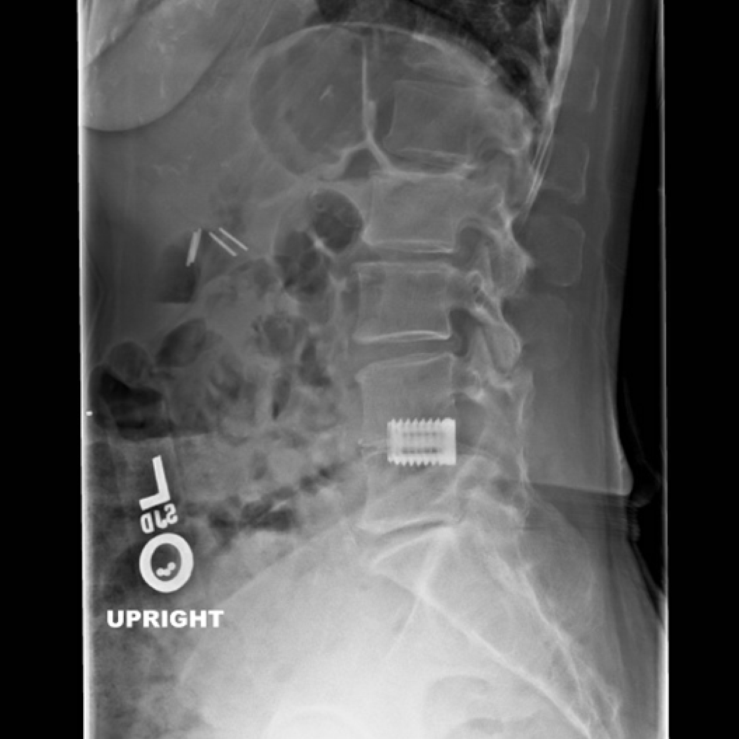 ramasamy elliquence case 5